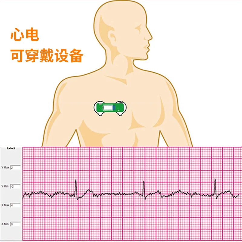 BMD101 ECG Electrocardiogram S - Ecg Patch Monitor avis et prix